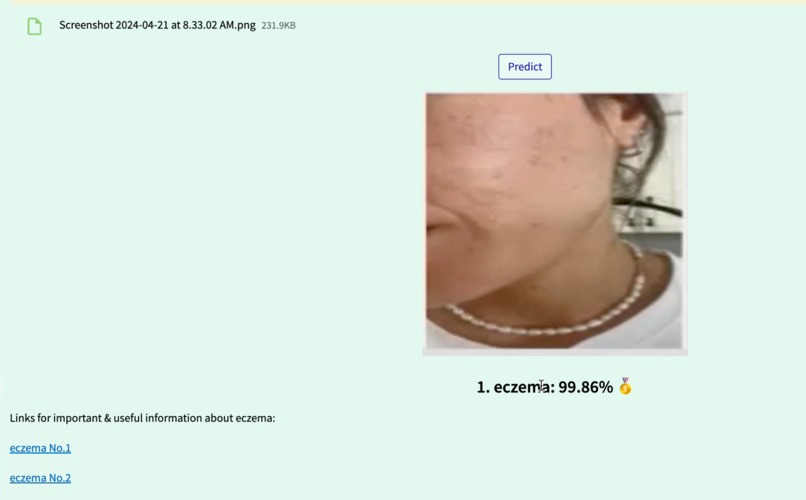 SkinScan AI – screenshot 4