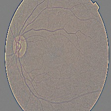 aicura – screenshot 1