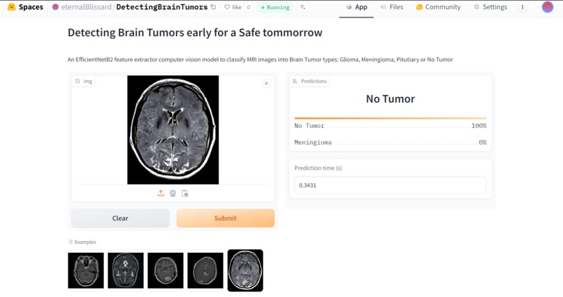 Brain Tumor Detector – screenshot 1