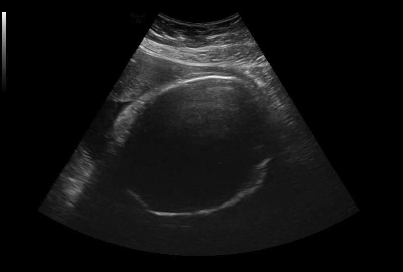 Fetal Head Mesurements – screenshot 2