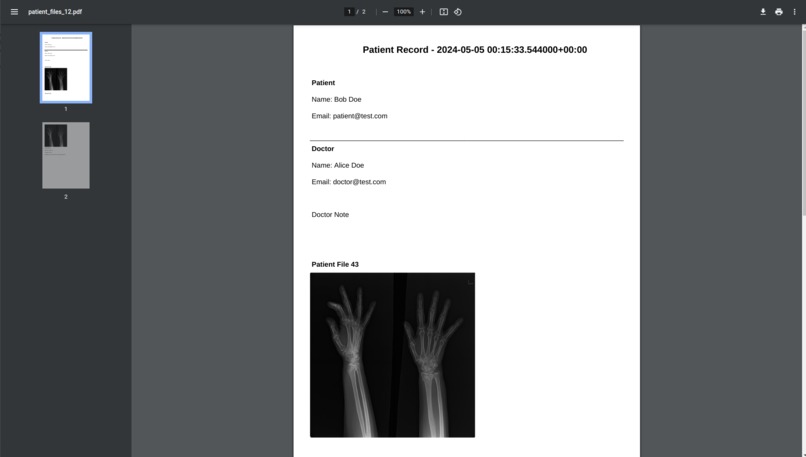 XRay AI fractures – screenshot 2