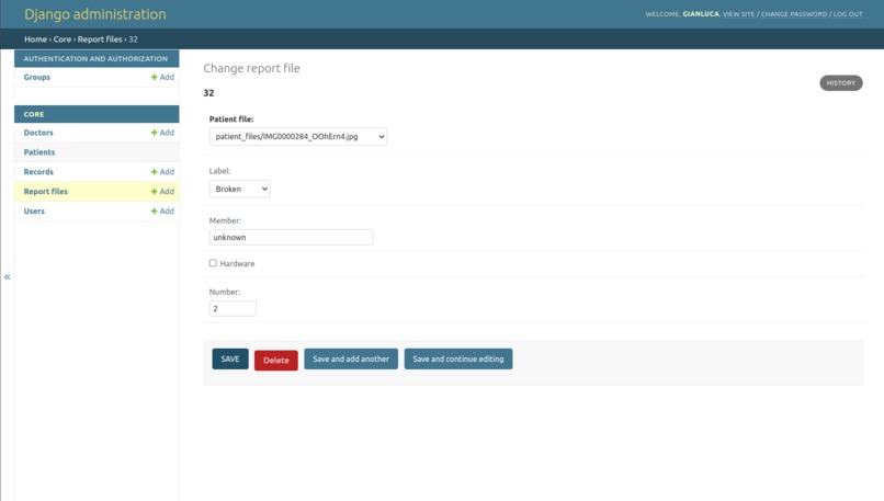 XRay AI fractures – screenshot 7