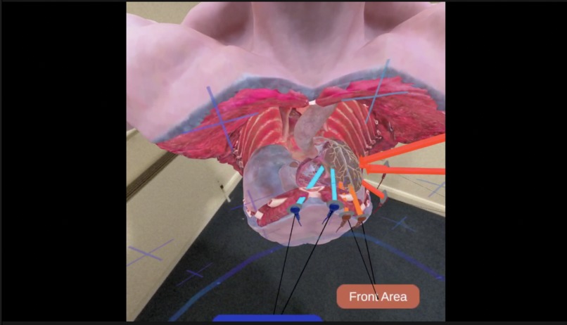 "Widowmaker" Heart Attack – screenshot 3