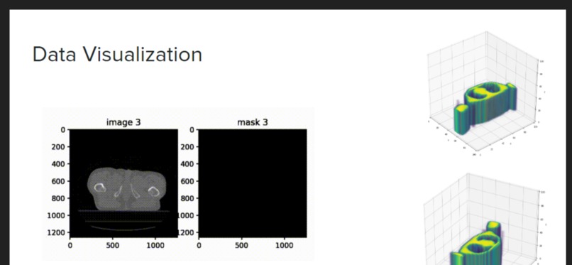 SegNeuro – screenshot 7
