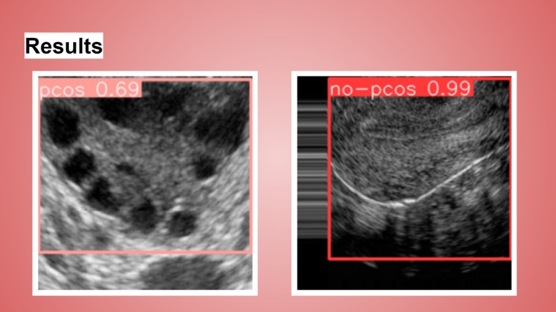 FemOvaAI – screenshot 4