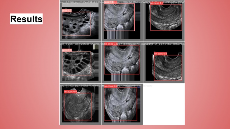 FemOvaAI – screenshot 5