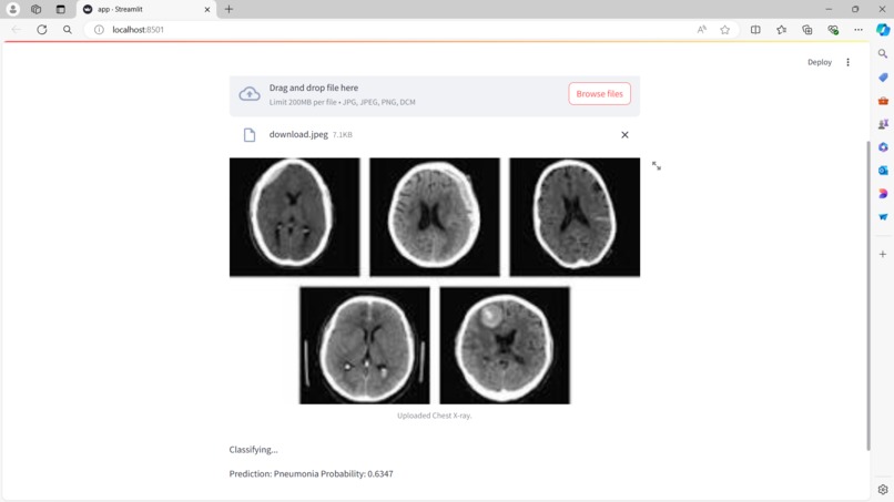 AI-based Diagnostic Tool for Medical Imaging – screenshot 2