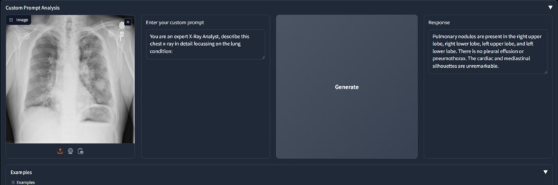 ChexRay Demo – screenshot 1