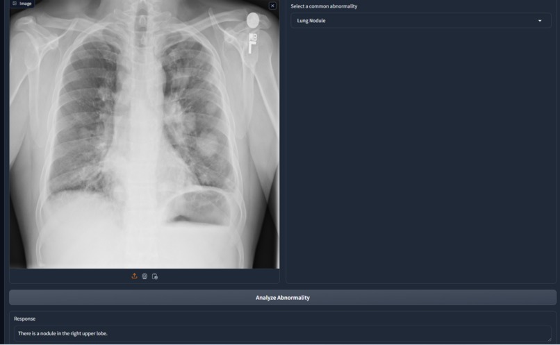 ChexRay Demo – screenshot 2