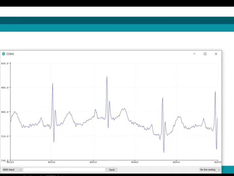 Real-Time Visualization of ECG and EMG Signals Indication  – screenshot 1