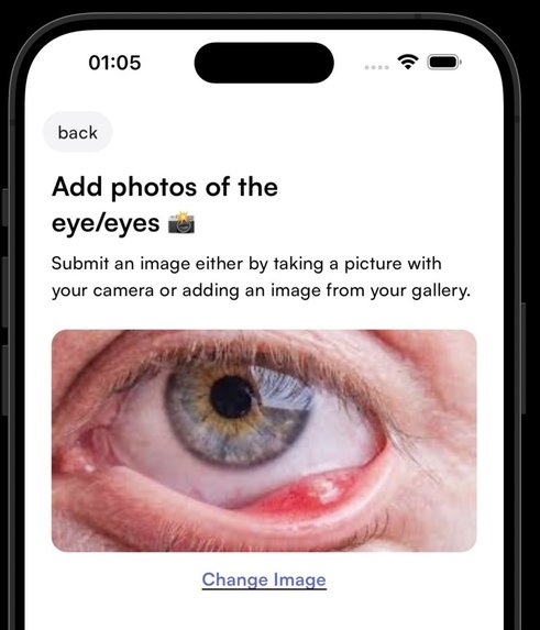 AiSight – screenshot 6