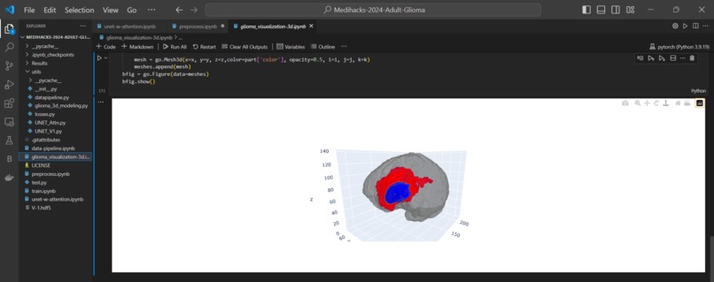 Automatic Efficient Segmentation of Adult Glioma Tumor – screenshot 18