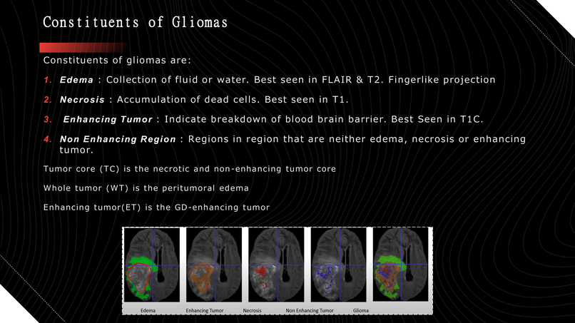Automatic Efficient Segmentation of Adult Glioma Tumor – screenshot 4