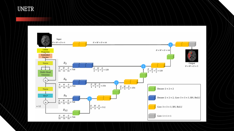 Automatic Efficient Segmentation of Adult Glioma Tumor – screenshot 10