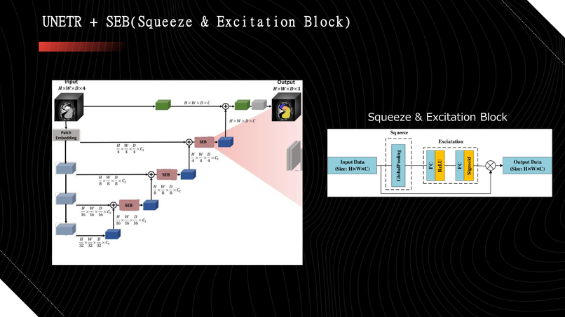 Automatic Efficient Segmentation of Adult Glioma Tumor – screenshot 11