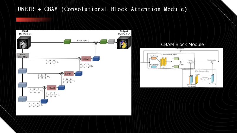 Automatic Efficient Segmentation of Adult Glioma Tumor – screenshot 12