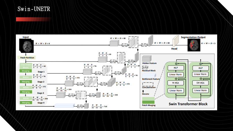 Automatic Efficient Segmentation of Adult Glioma Tumor – screenshot 13