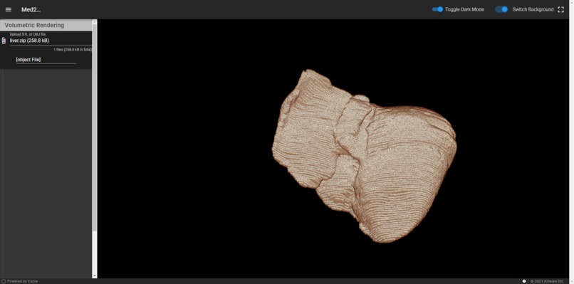 3D reconstruction of 2D Medical Scans – screenshot 1