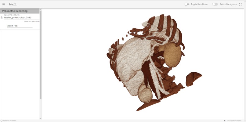3D reconstruction of 2D Medical Scans – screenshot 3