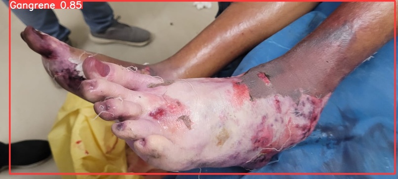 Gangrene detection  – screenshot 2