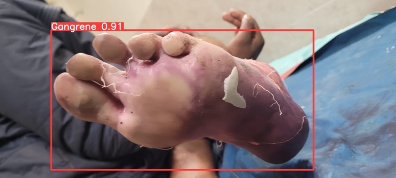 Gangrene detection  – screenshot 3