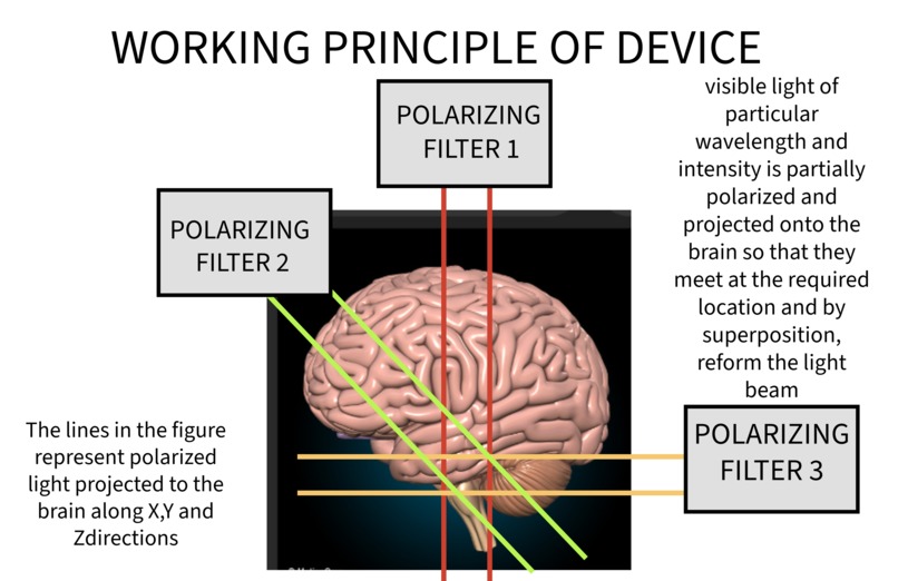 Parkinson's disease Predictor – screenshot 1