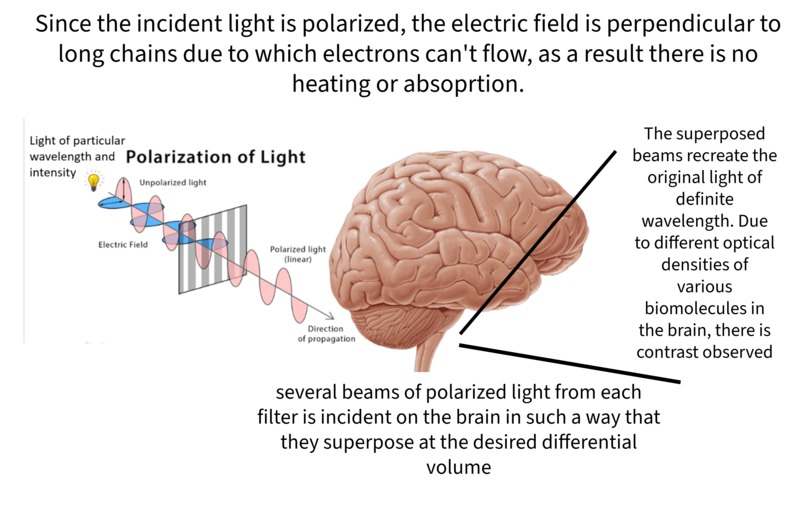 Parkinson's disease Predictor – screenshot 3