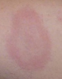 LANTERN – screenshot 1