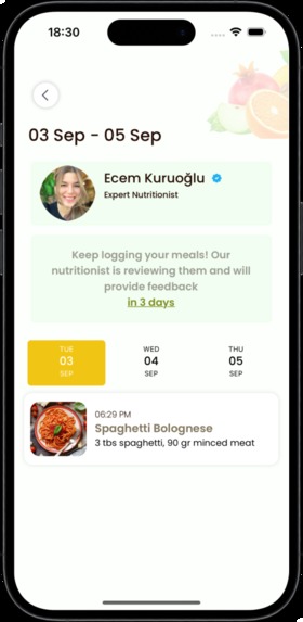 Nuty・Intuitive Eating Meal Log  – screenshot 2