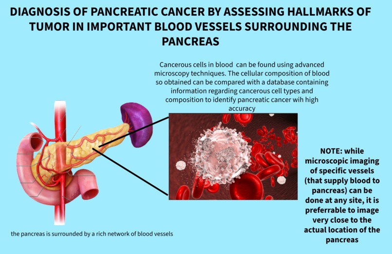(Pancreatic) Cancer Predictor – screenshot 1