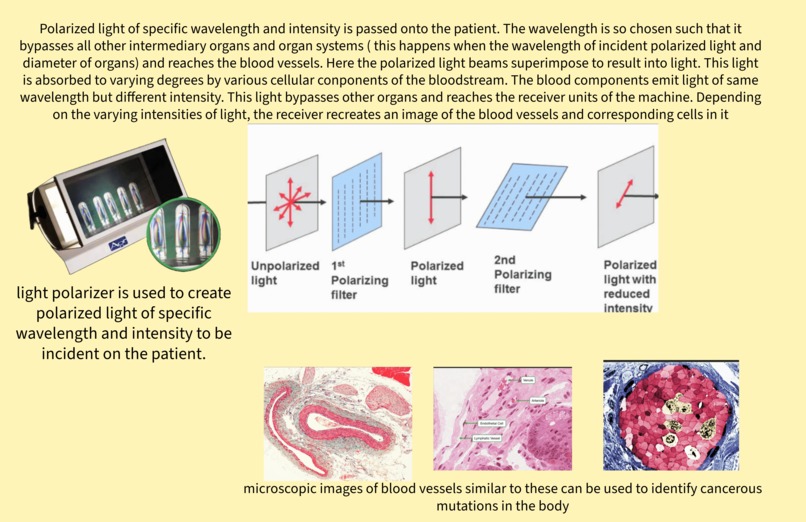 (Pancreatic) Cancer Predictor – screenshot 3