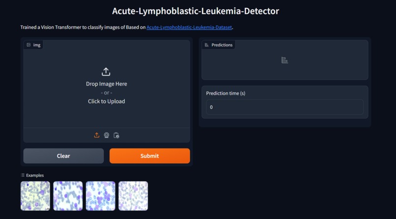 Acute Lymphoblastic Leukemia Detector – screenshot 1