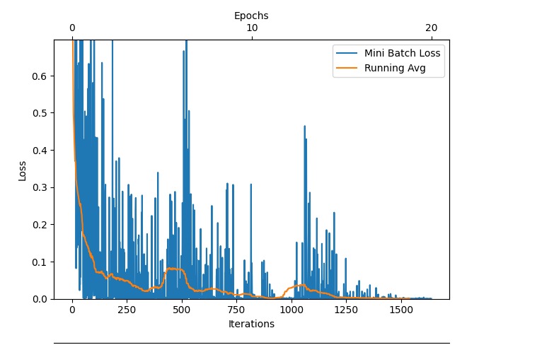 Acute Lymphoblastic Leukemia Detector – screenshot 3
