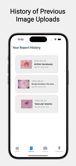 SkinGuard AI – screenshot 3