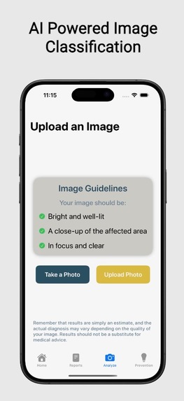 SkinGuard AI – screenshot 4