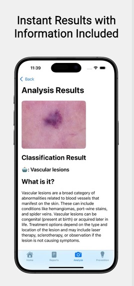 SkinGuard AI – screenshot 5
