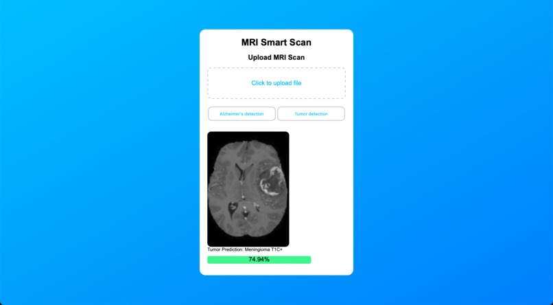 MRI Smart Scan – screenshot 2