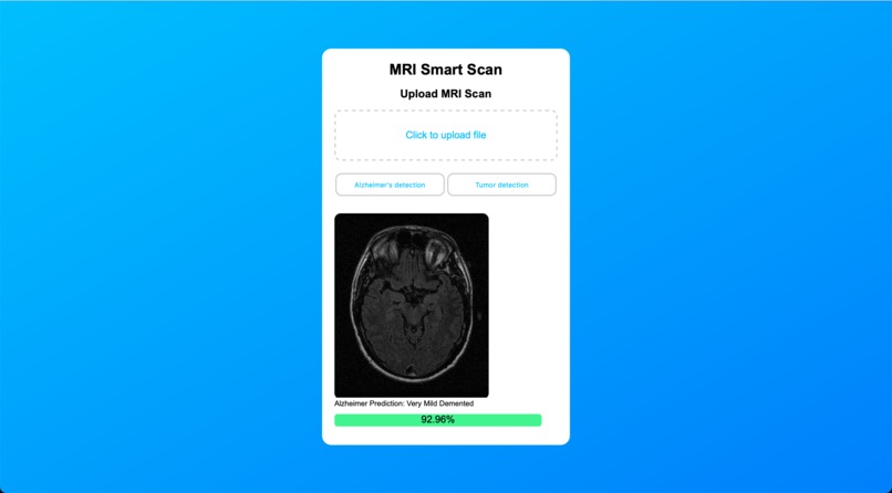 MRI Smart Scan – screenshot 3
