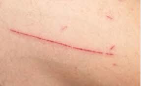 DiagnosisAI – screenshot 1