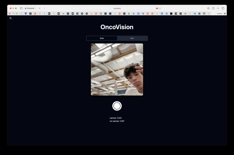 OncoVision – screenshot 1