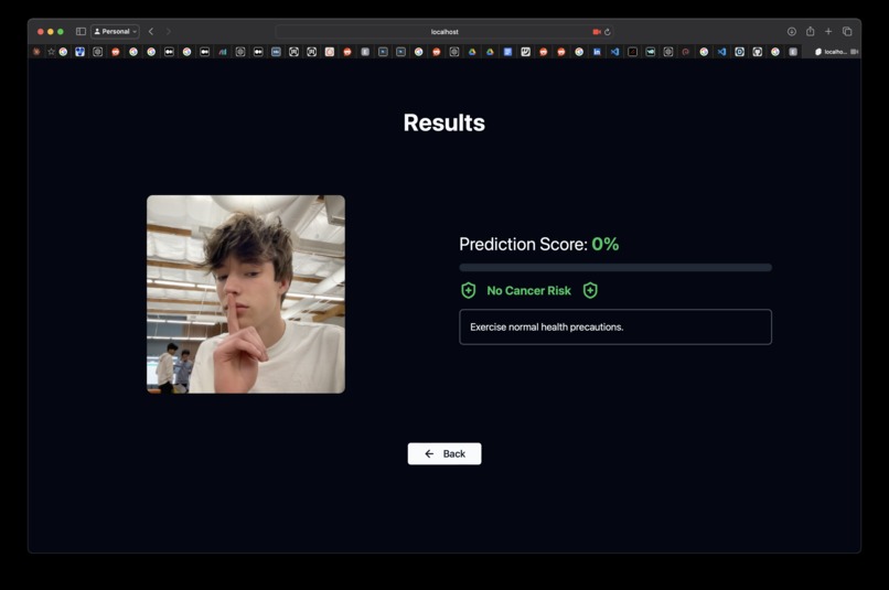 OncoVision – screenshot 2