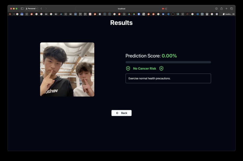 OncoVision – screenshot 3