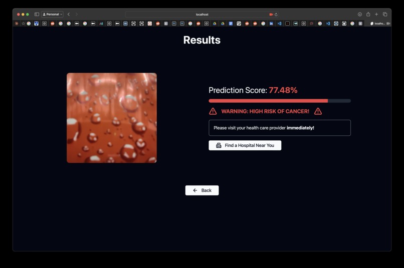 OncoVision – screenshot 4