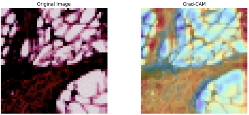 AI Breast Cancer Image Annotation – screenshot 2