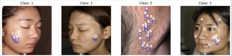 DermaScan – screenshot 1