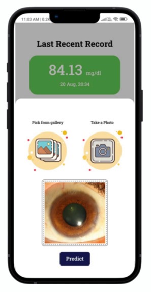 GlucoLens – screenshot 2
