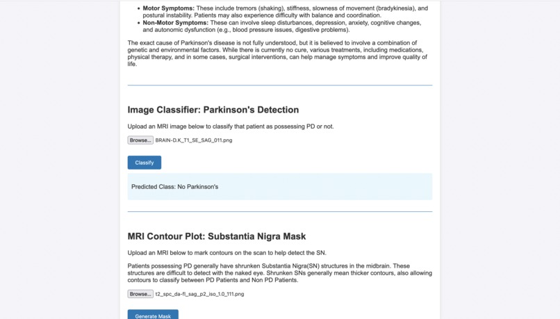 PD Contour – screenshot 3