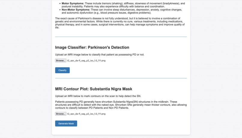 PD Contour – screenshot 5