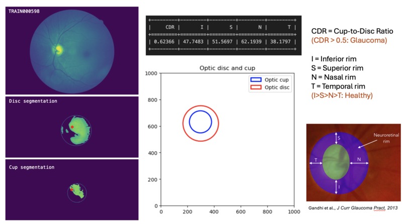 InsEYEte – screenshot 1