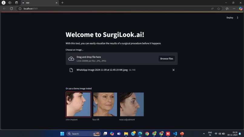 Deep Plastic Surgery - Surgilook.ai – screenshot 1